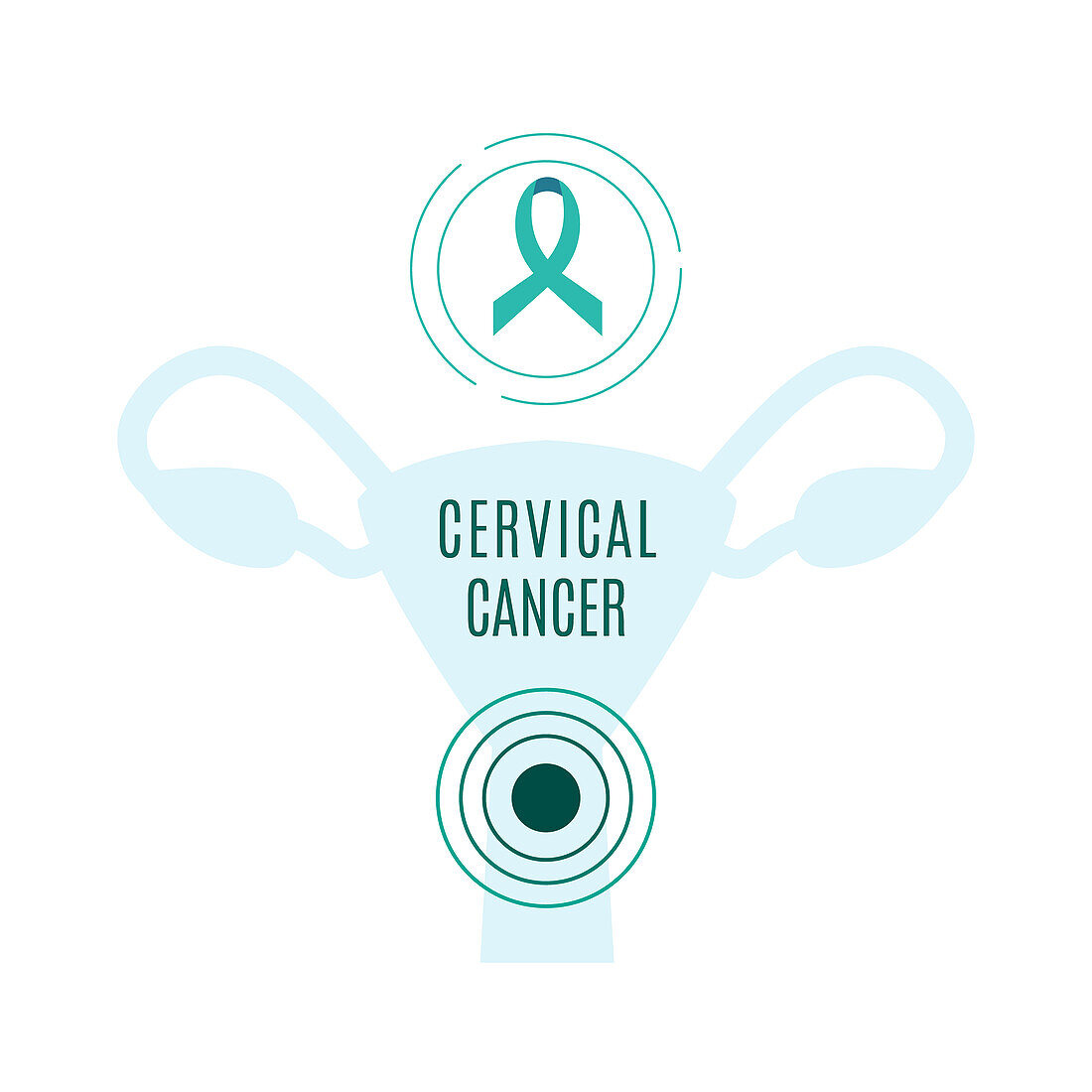 Cervical cancer awareness ribbon, conceptual illustration