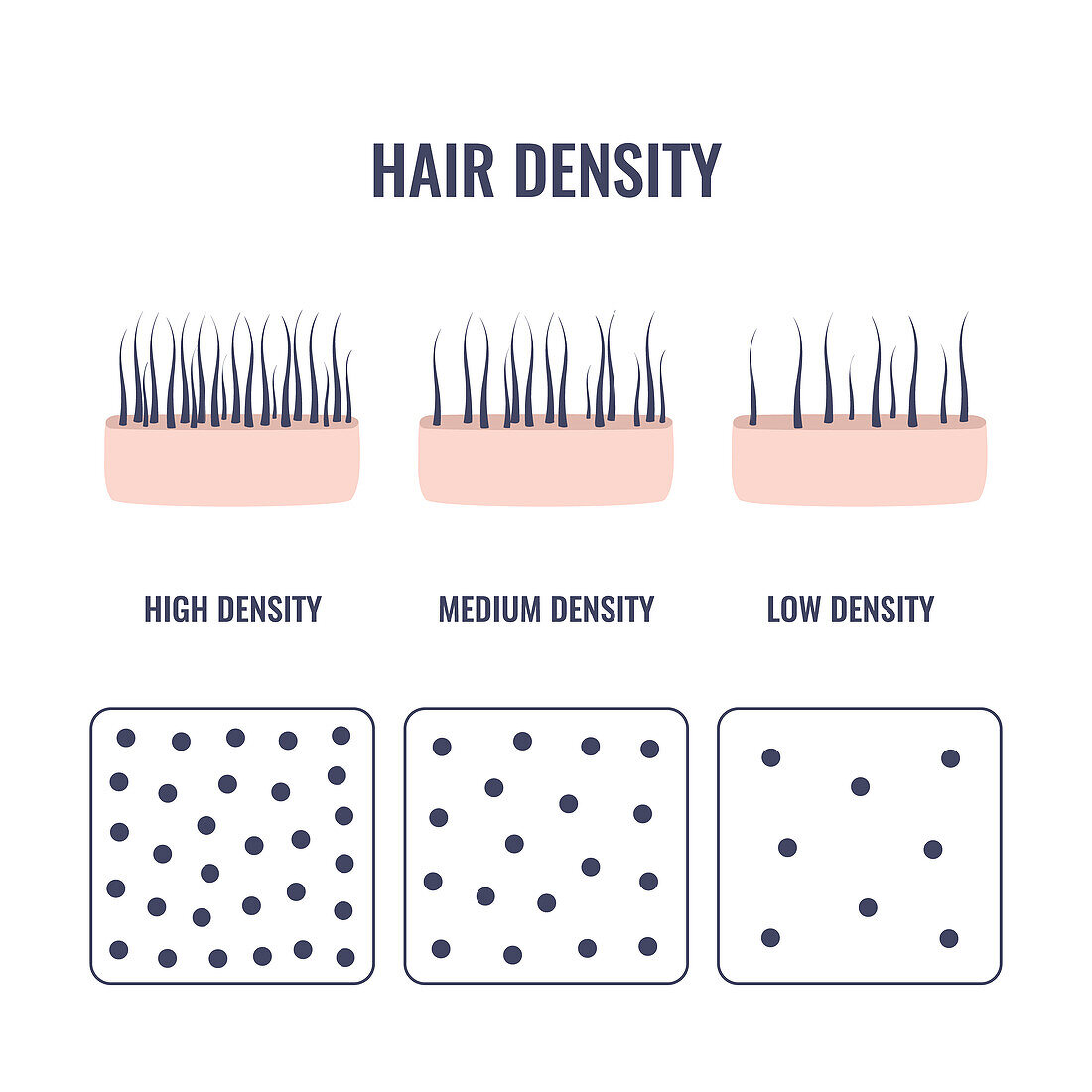 Hair density types, conceptual illustration