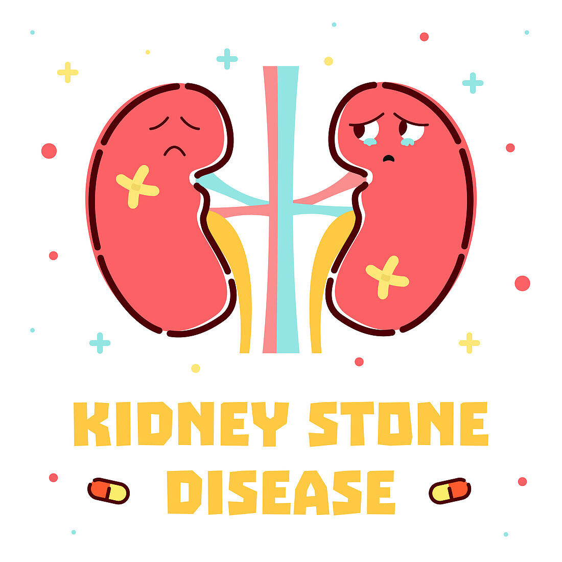 Kidney stone disease, conceptual illustration