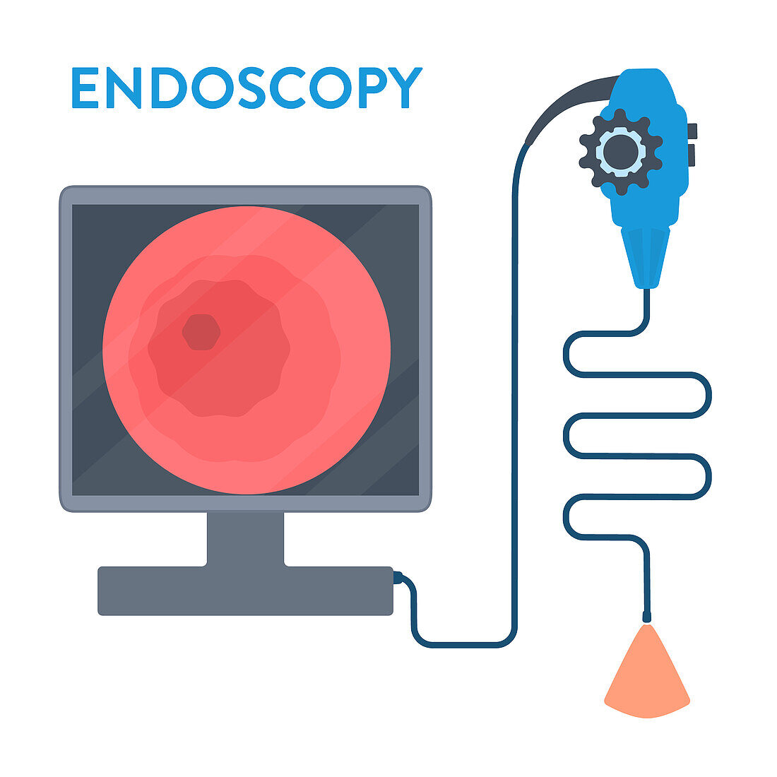 Endoscopy, conceptual illustration