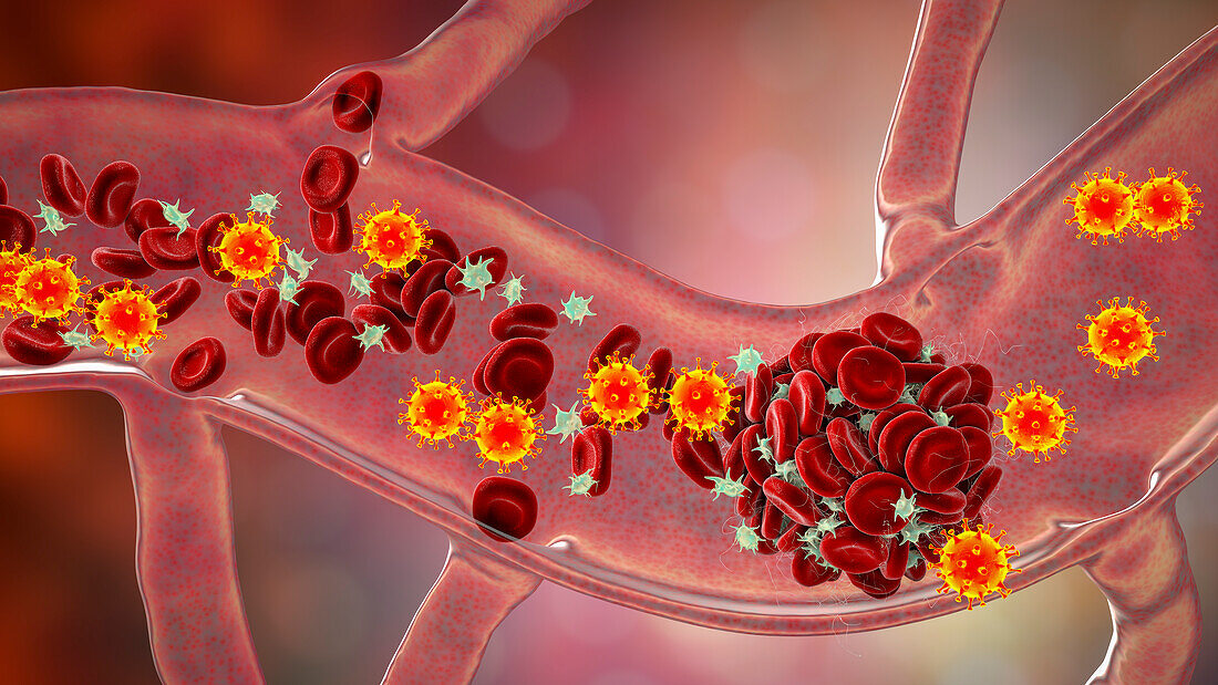 COVID-19 virus and activated platelets, illustration