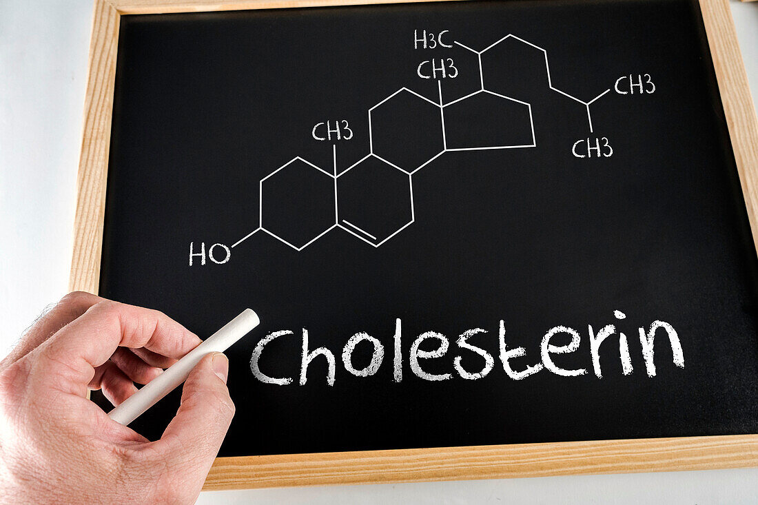 Chemical composition of cholesterol, conceptual image