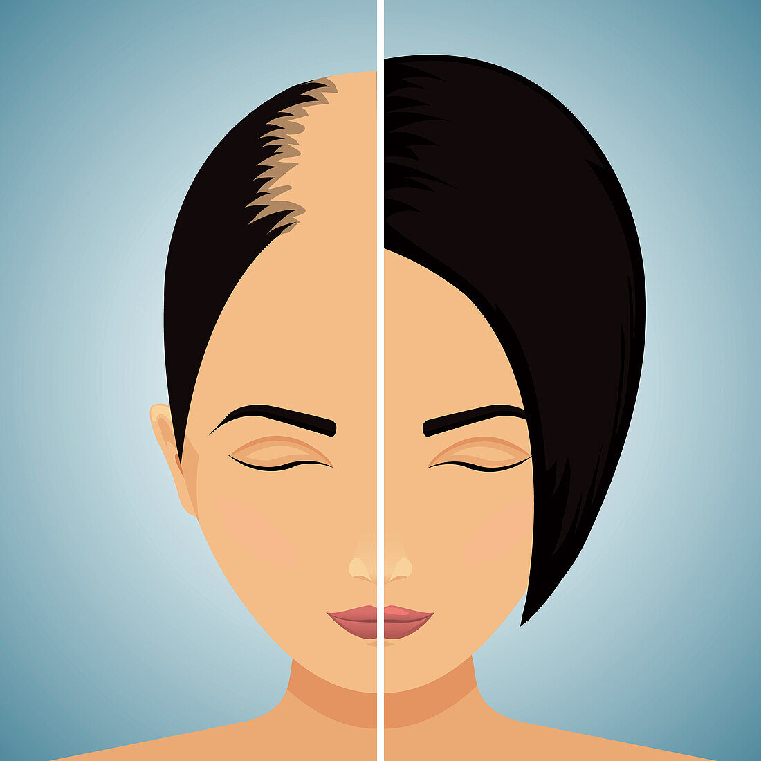 Hair loss in women, conceptual illustration