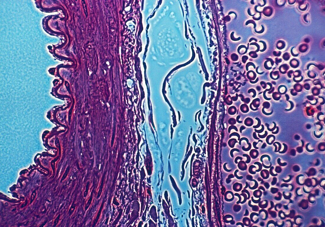 LM of a human artery & vein