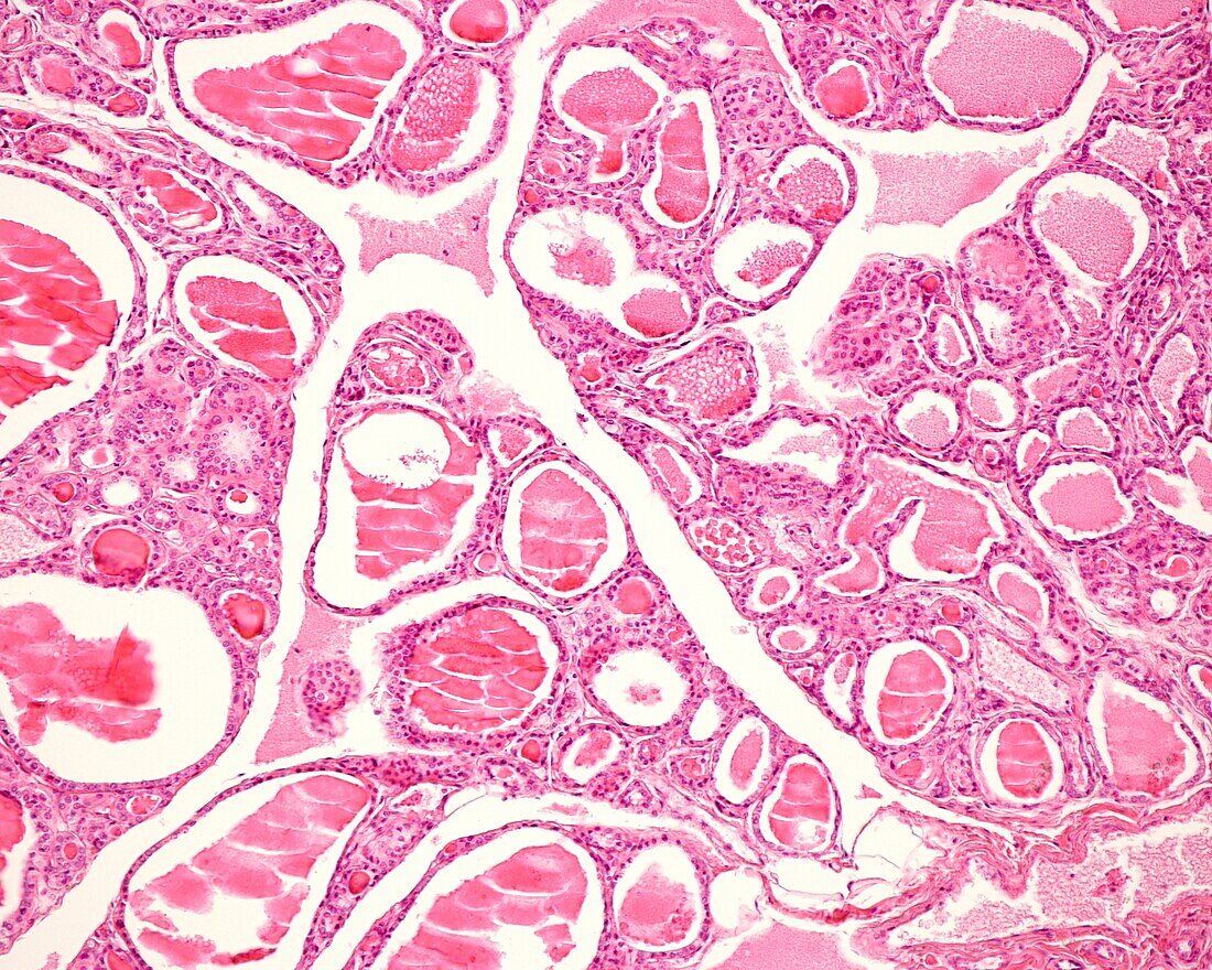 Human Thyroid Gland Light Micrograph Acheter Une Photo 13511477