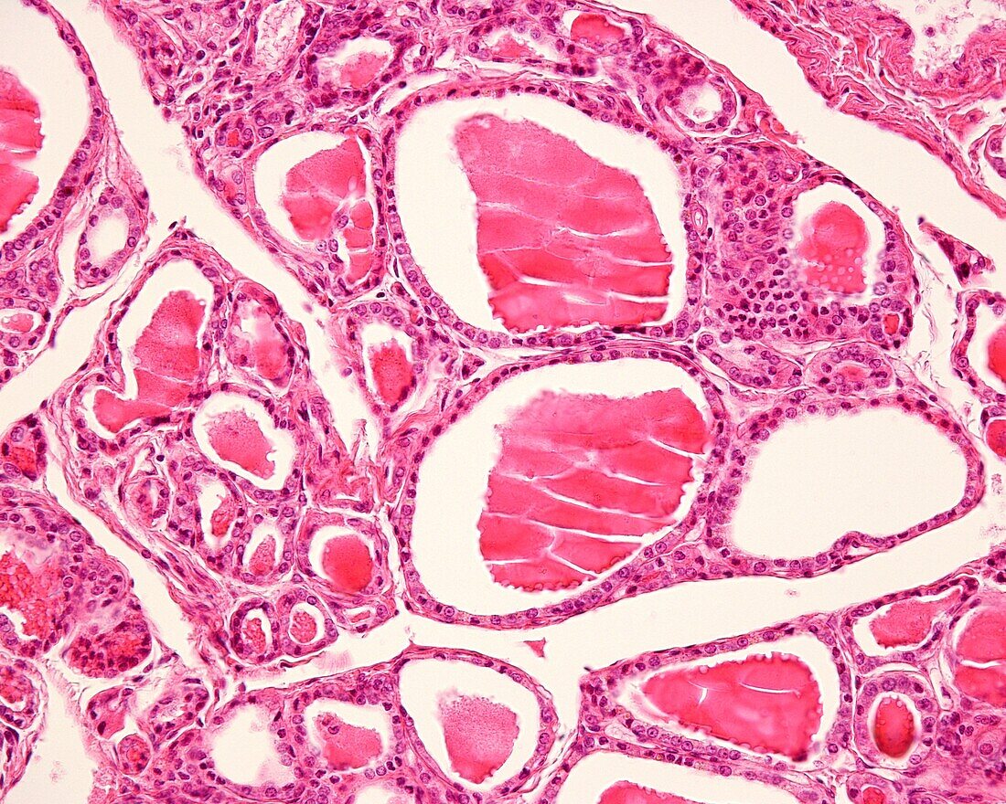 Human thyroid gland follicles, light micrograph