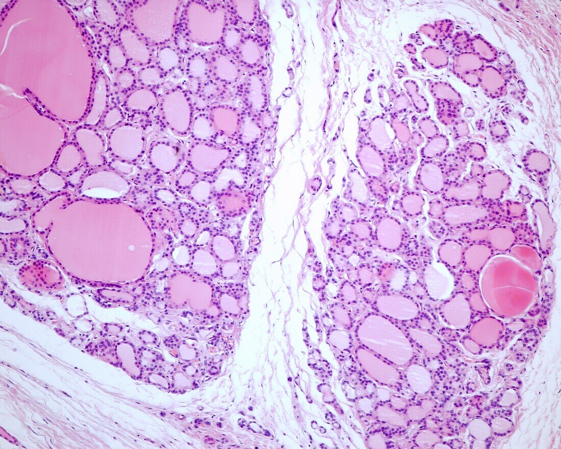 Human thyroid gland, light micrograph