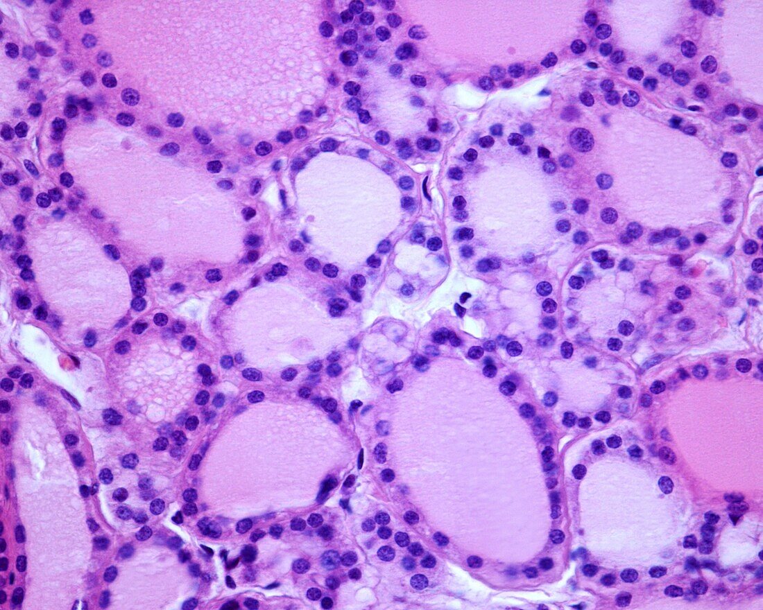 Human thyroid gland follicle epithelium, light micrograph