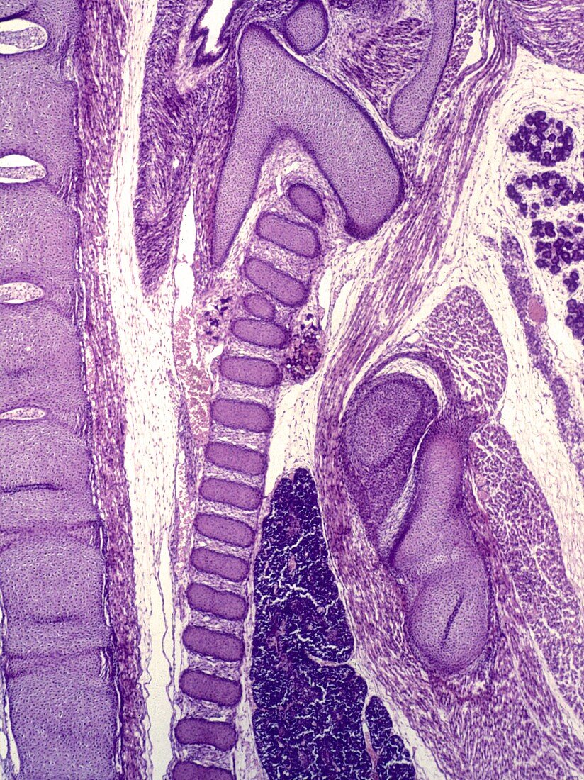 Development of the thyroid gland, light micrograph