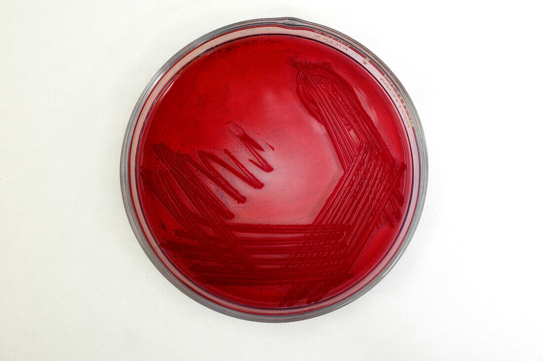 E. coli sample