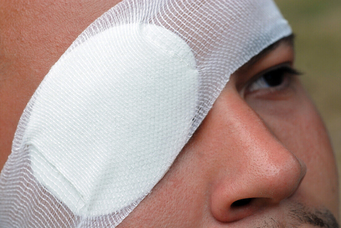 Man wearing an eye patch.