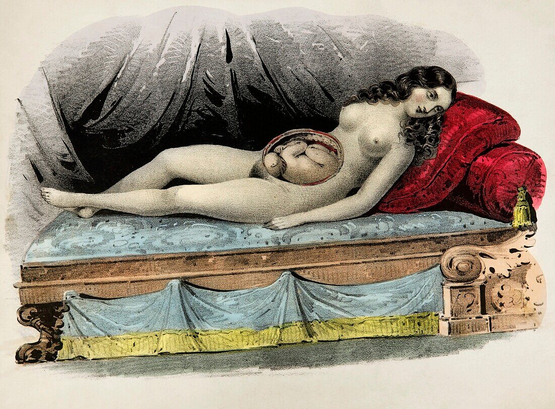 Pregnant woman, 19th century illustration