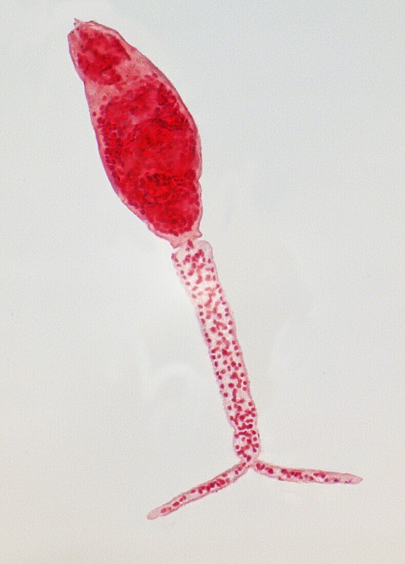 Schistosoma larva, LM
