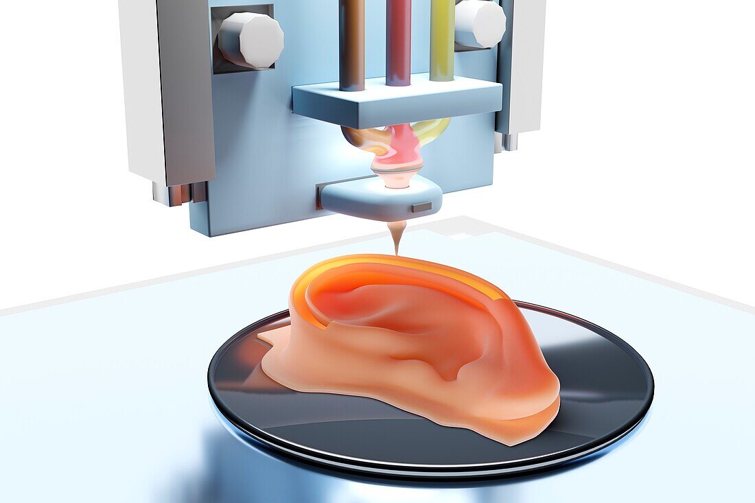 3D printing of an ear prosthesis, illustration