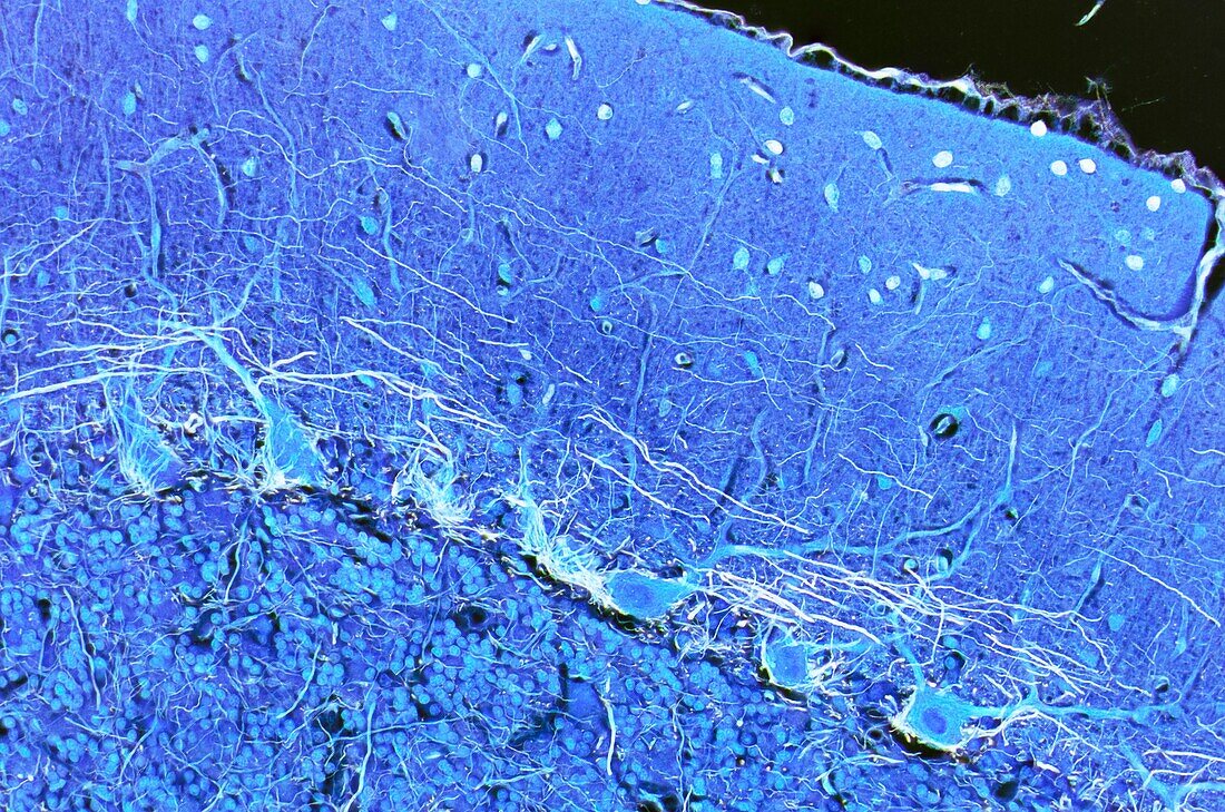 Purkinje nerve cells, LM