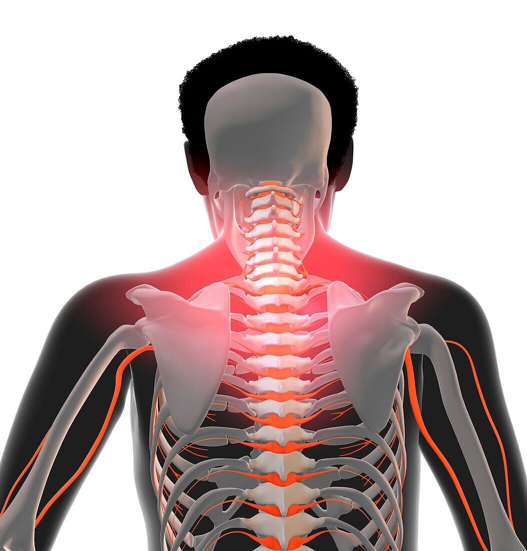 Neck and back pain, illustration