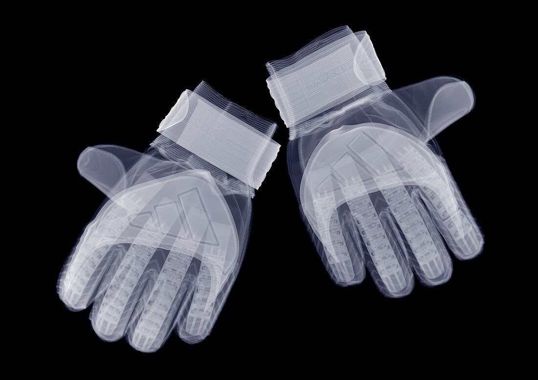 Pair of gloves, X-ray