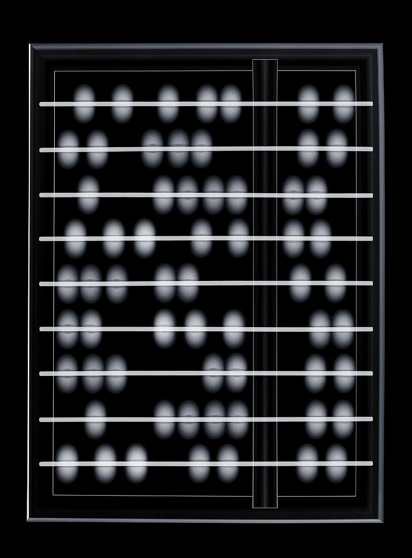 Abacus, X-ray