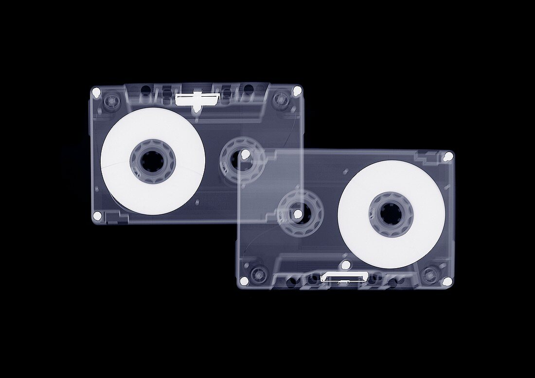 Two audio cassettes, X-ray