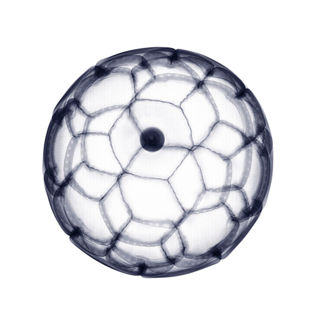 Leather football, X-ray