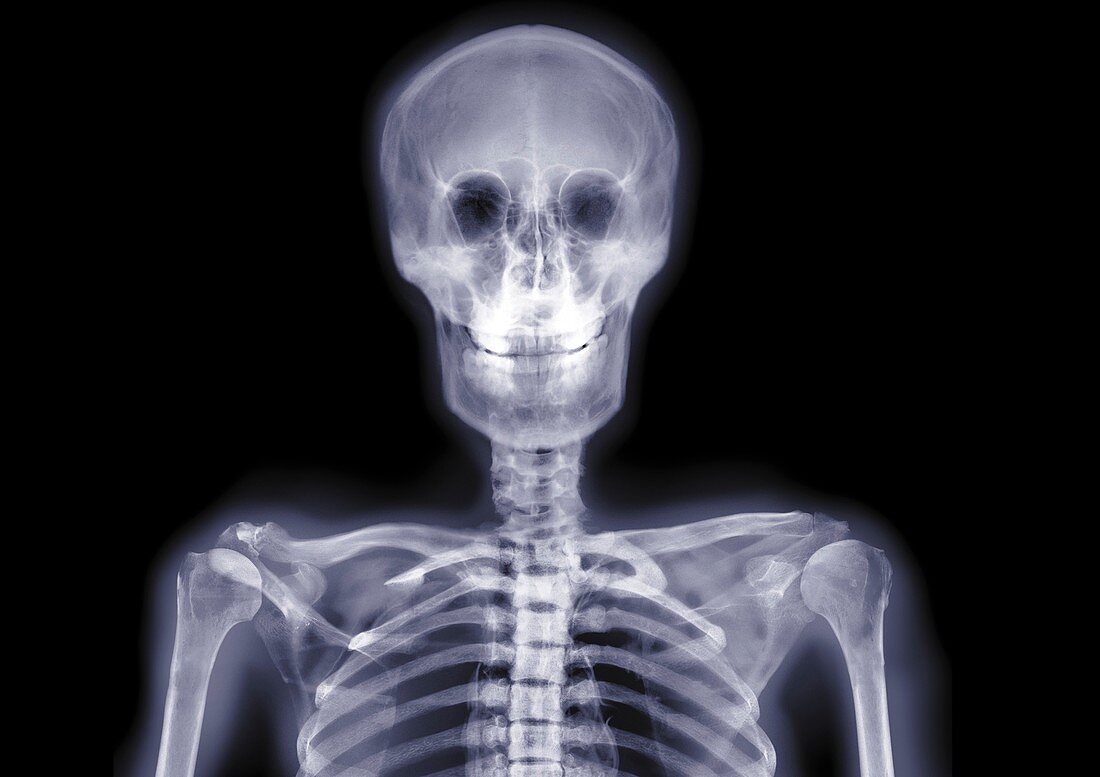 Skull and shoulders smiling, X-ray