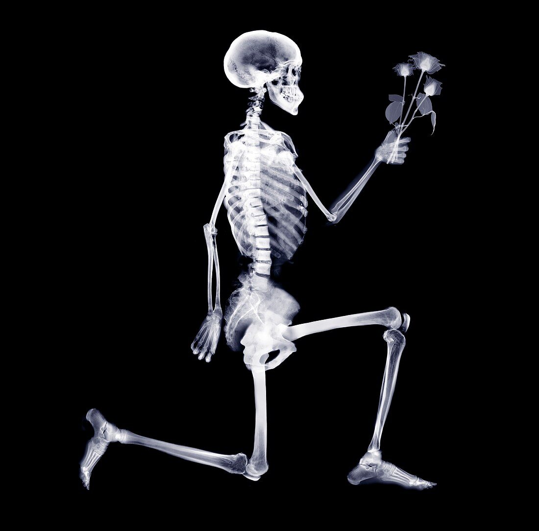 Skeleton proposing, X-ray