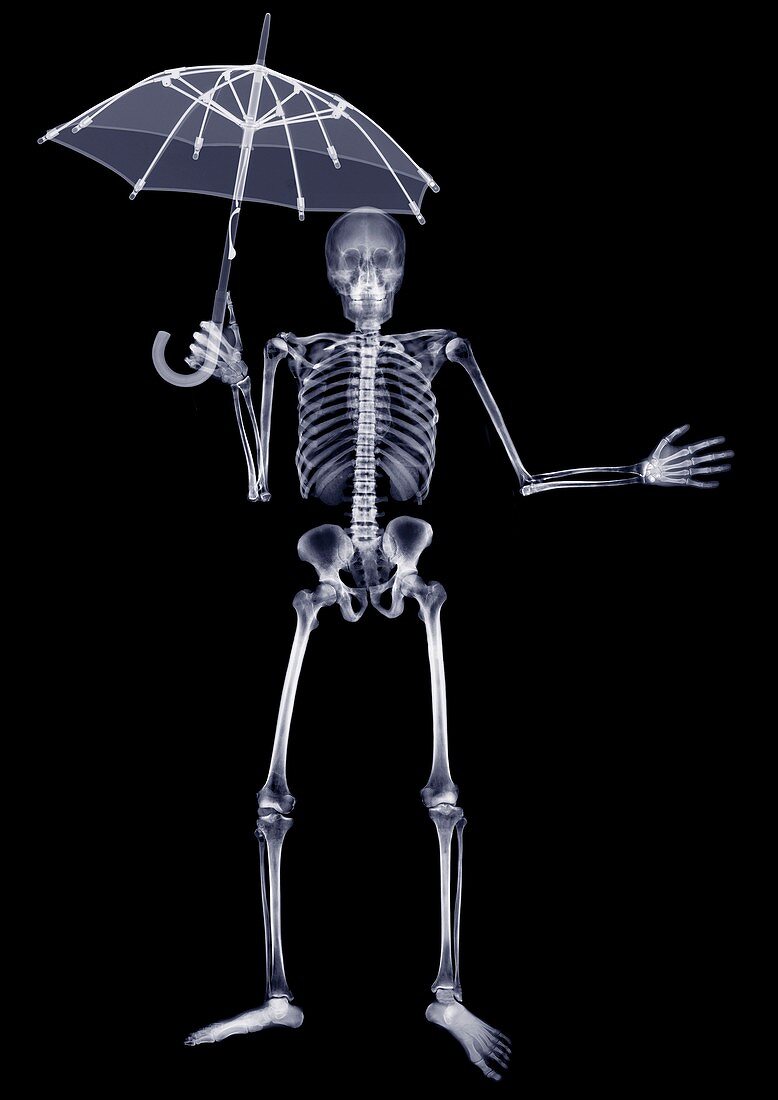 Skeleton holding an open umbrella above him, X-ray