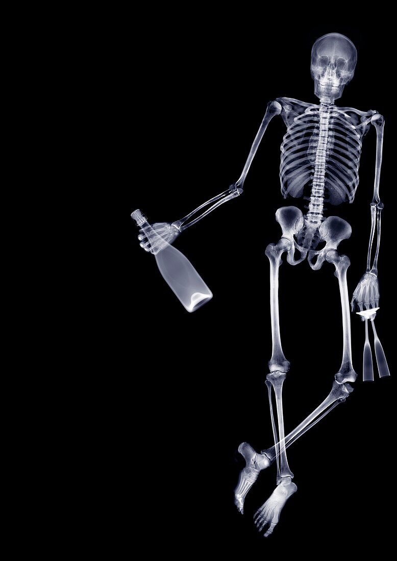 Skeleton holding champagne and two glasses, X-ray