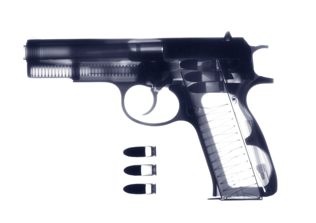 Handgun and bullets, X-ray