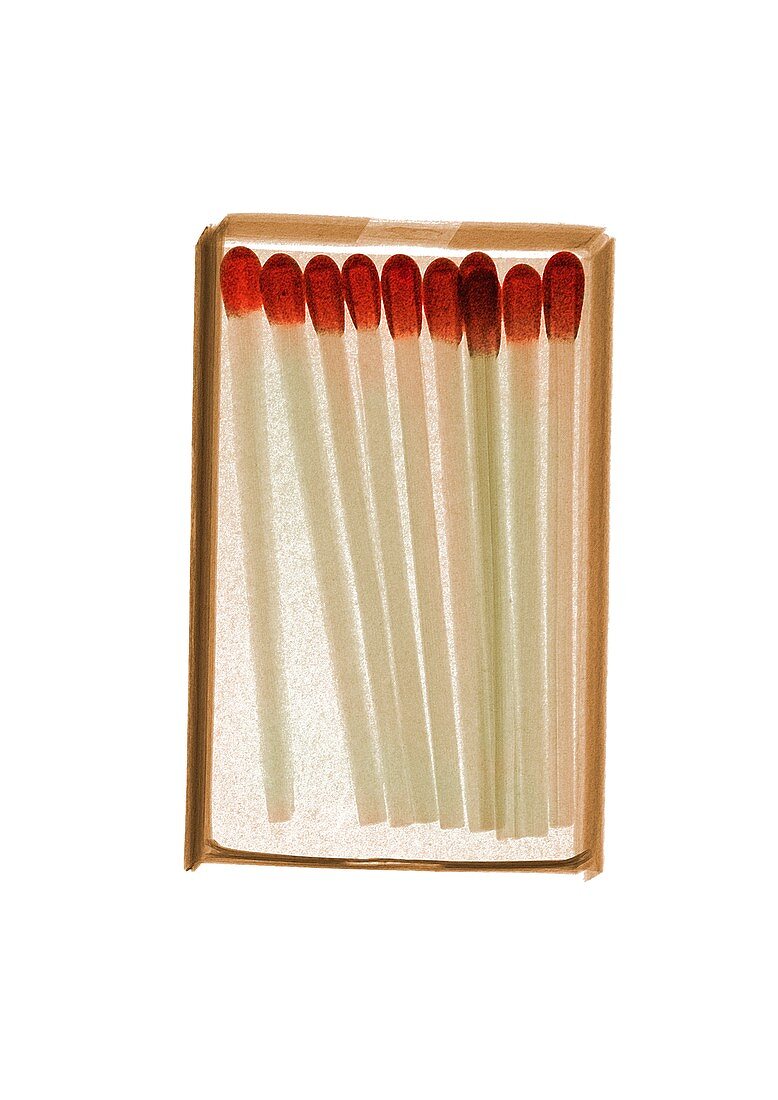 Box of matches, X-ray