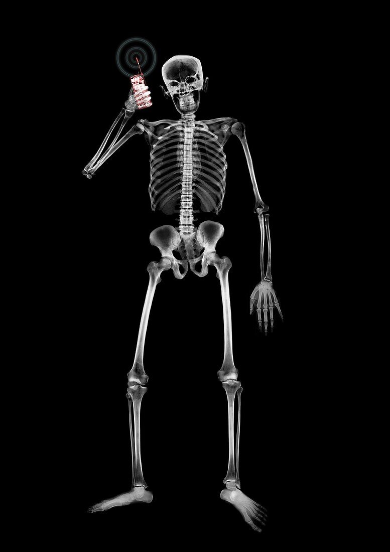 Human skeleton answering mobile phone, X-ray