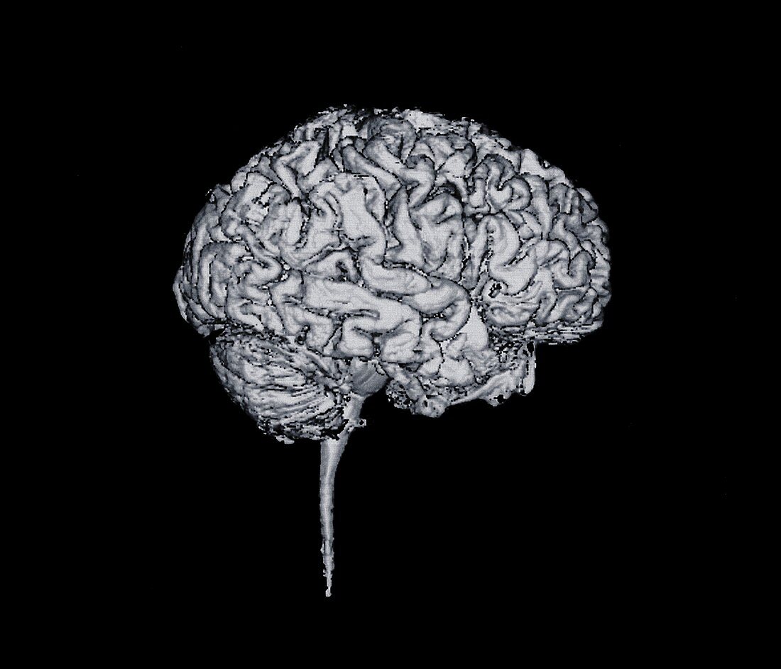 Side view of brain, X-ray