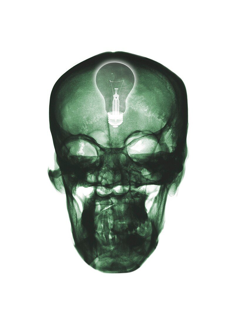 Human skull and light bulb, X-ray