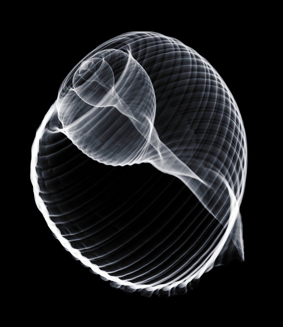 Periwinkle shell, X-ray