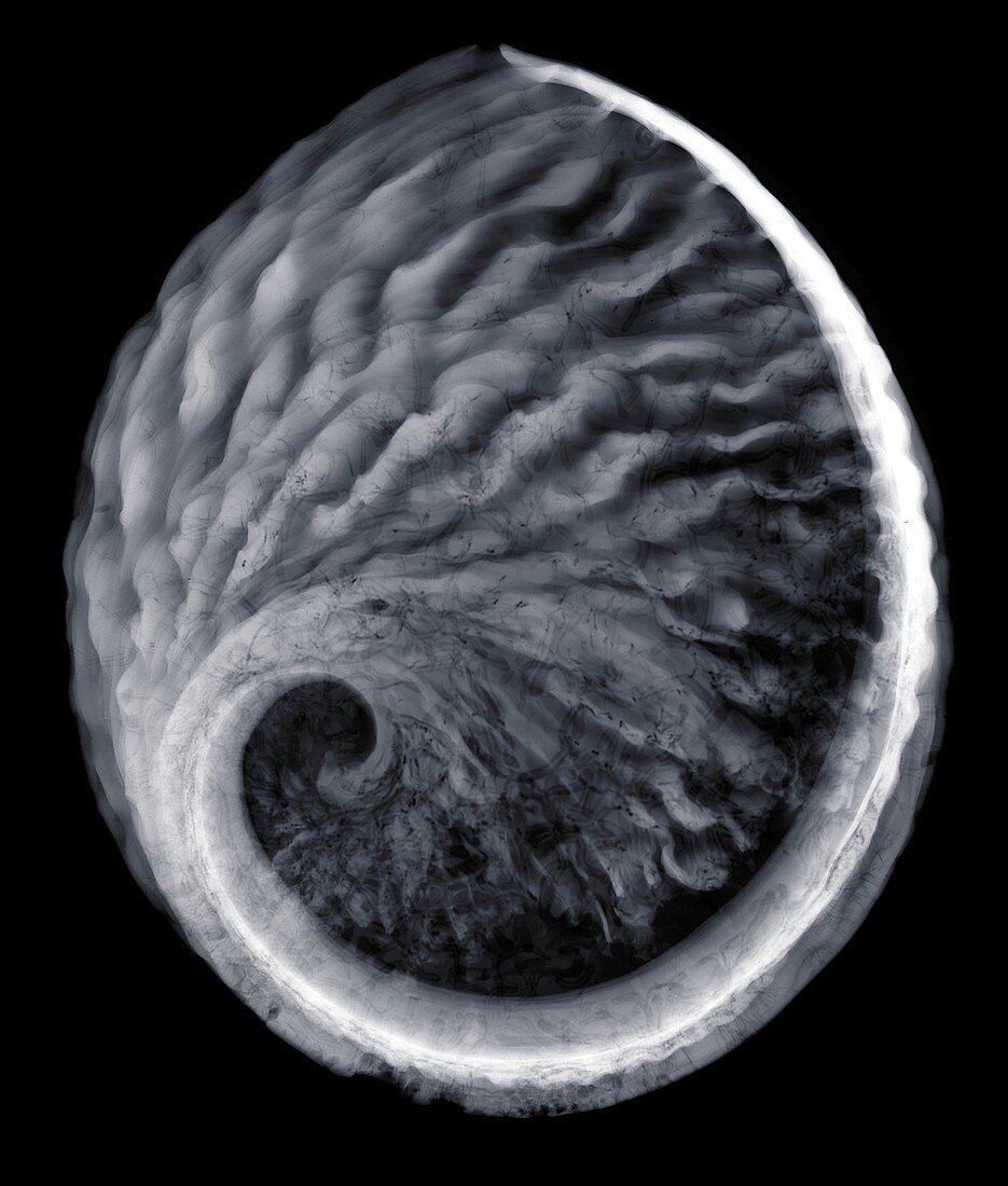 Underneath of a sea shell, X-ray