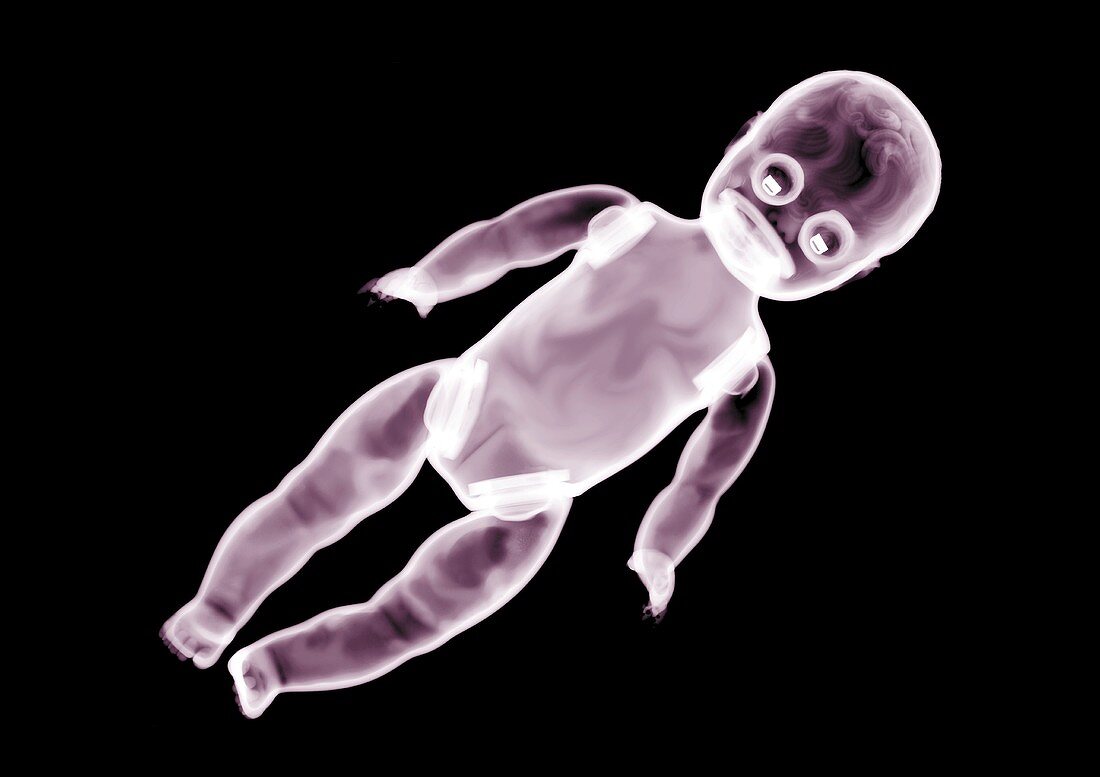 Baby doll, X-ray