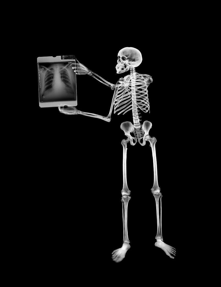 Skeleton looking at x-ray film, X-ray