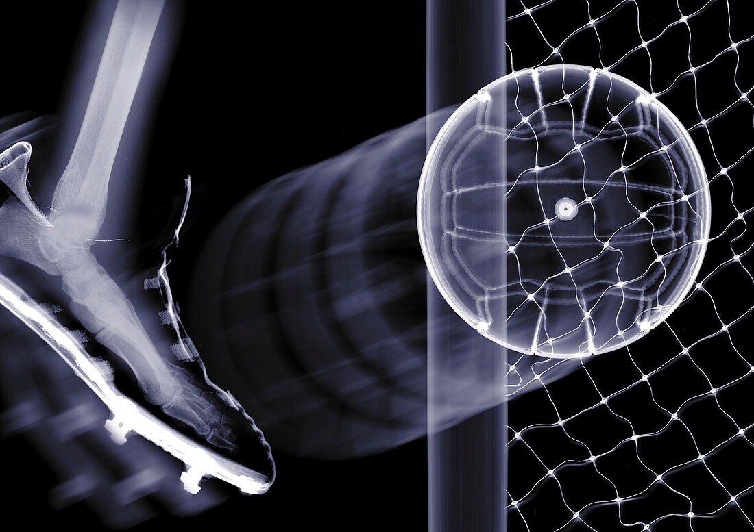 Kicking a football into a net, X-ray