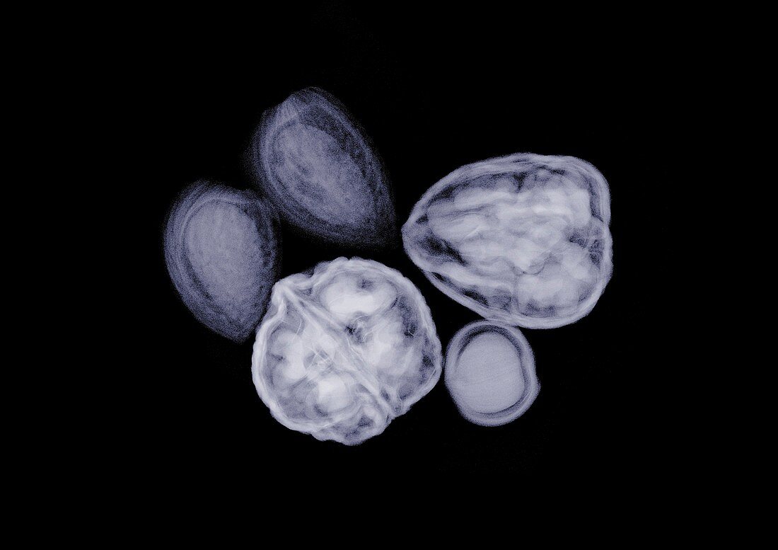 Assorted nuts, X-ray