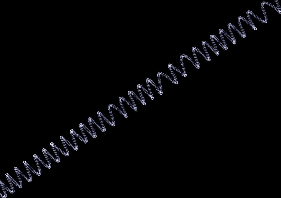 Spiral telephone wire, X-ray