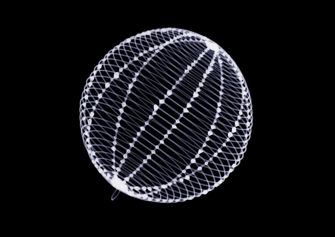 Metal sphere ornament, X-ray