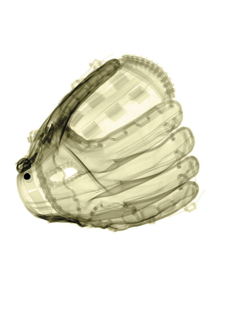 Baseball glove coloured, X-ray