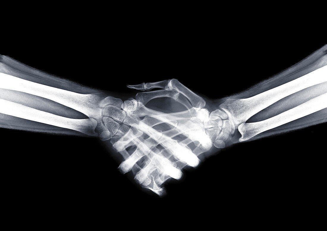 Handshake, X-ray