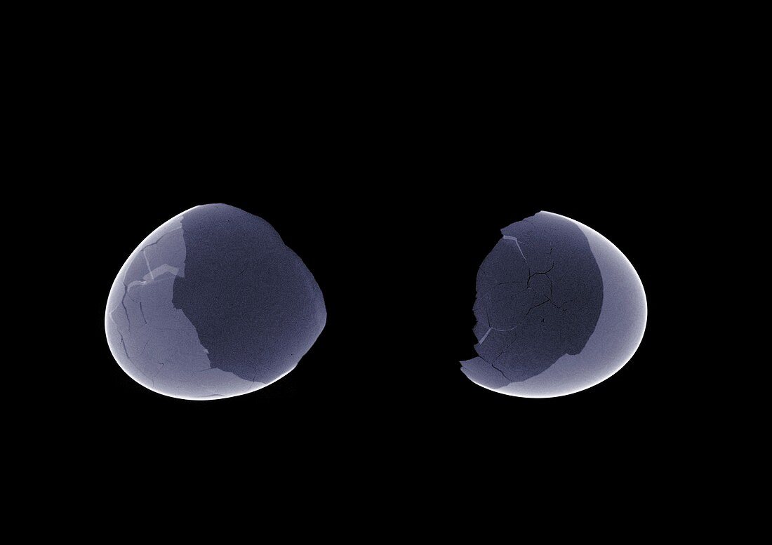 Broken egg shell, X-ray