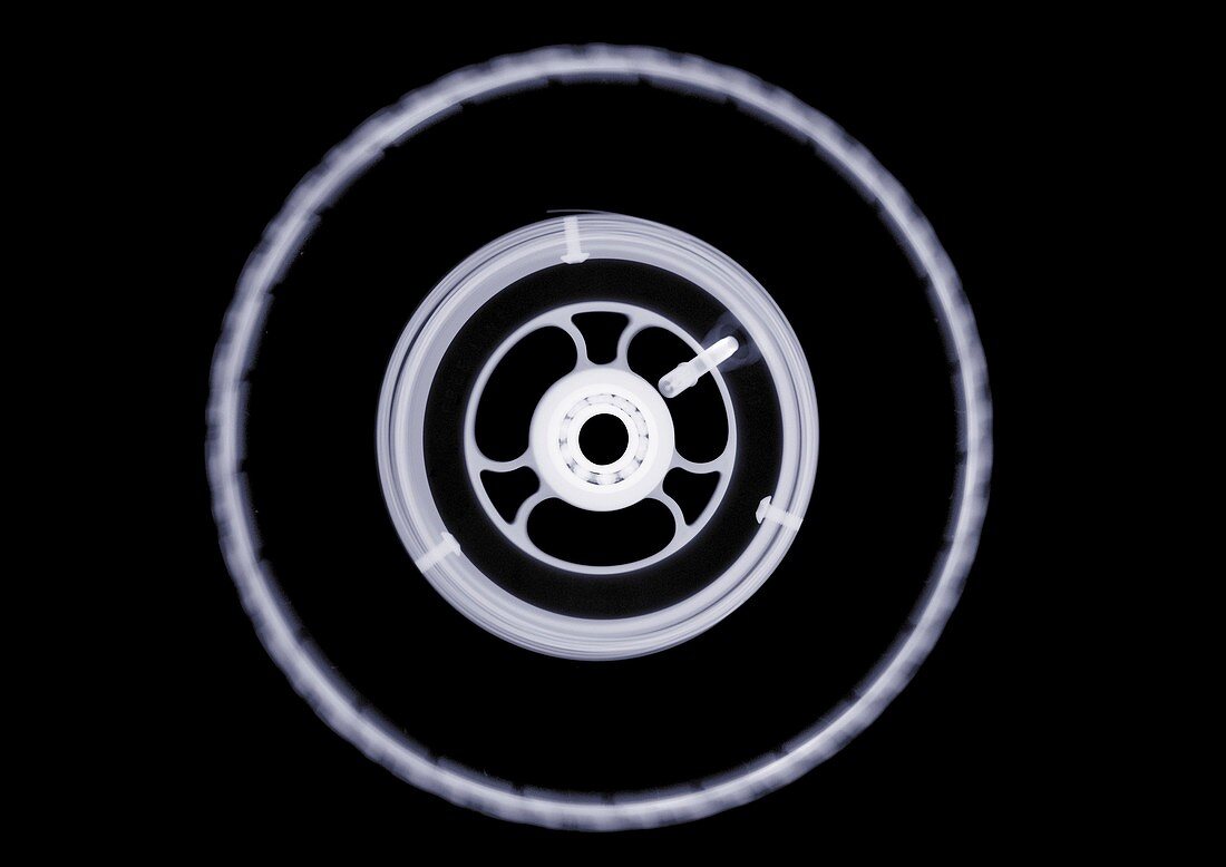 Tyre, X-ray