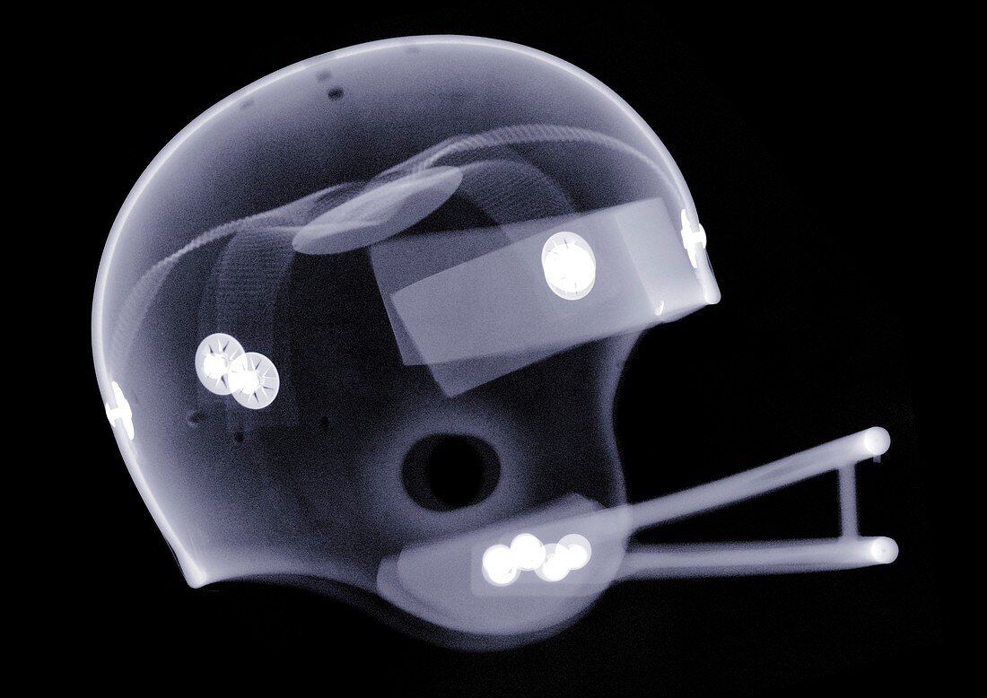 American football helmet, X-ray