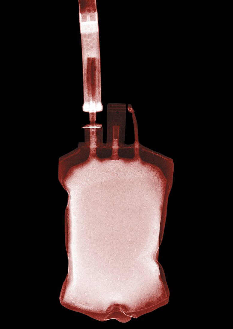 Bag filled with blood, X-ray