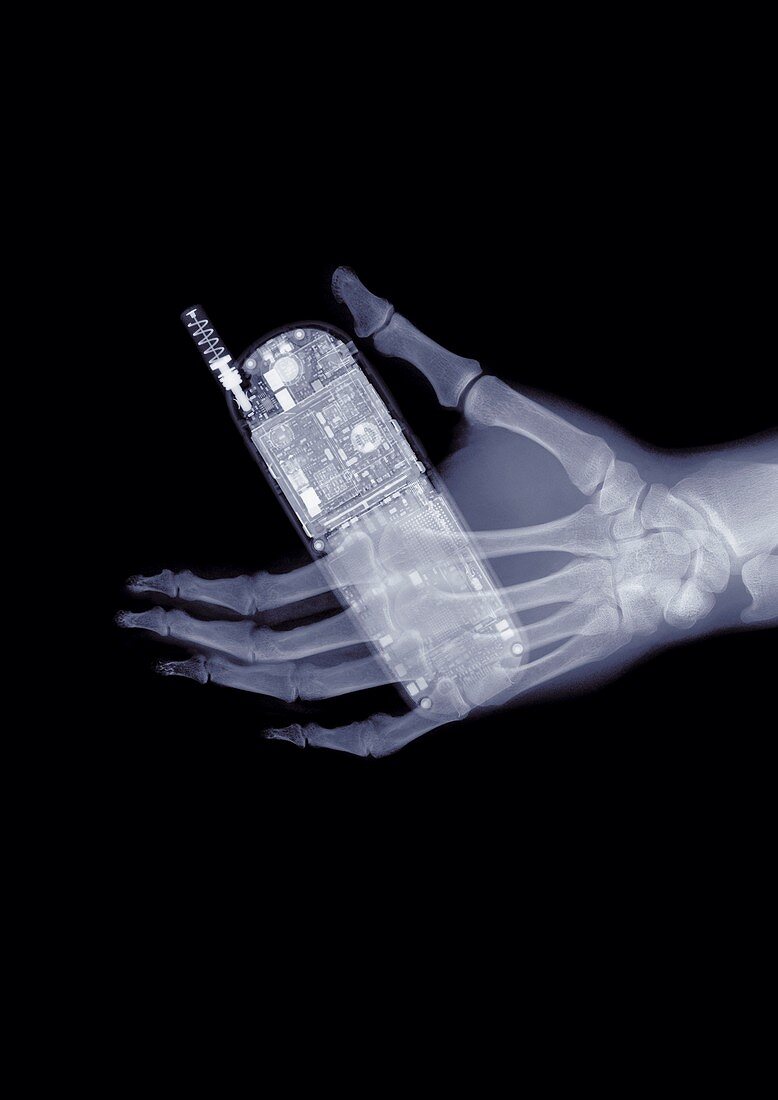 Hand holding a mobile phone, X-ray
