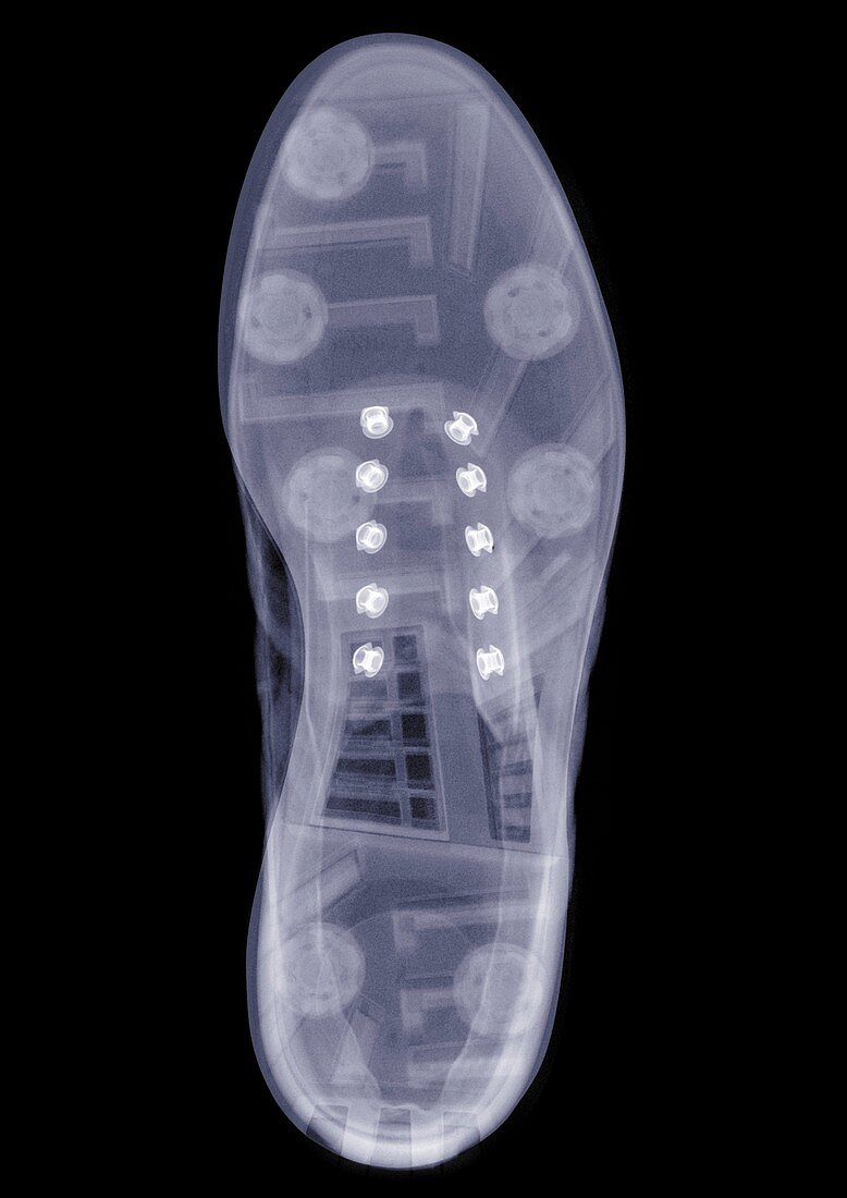 Shoe sole, X-ray