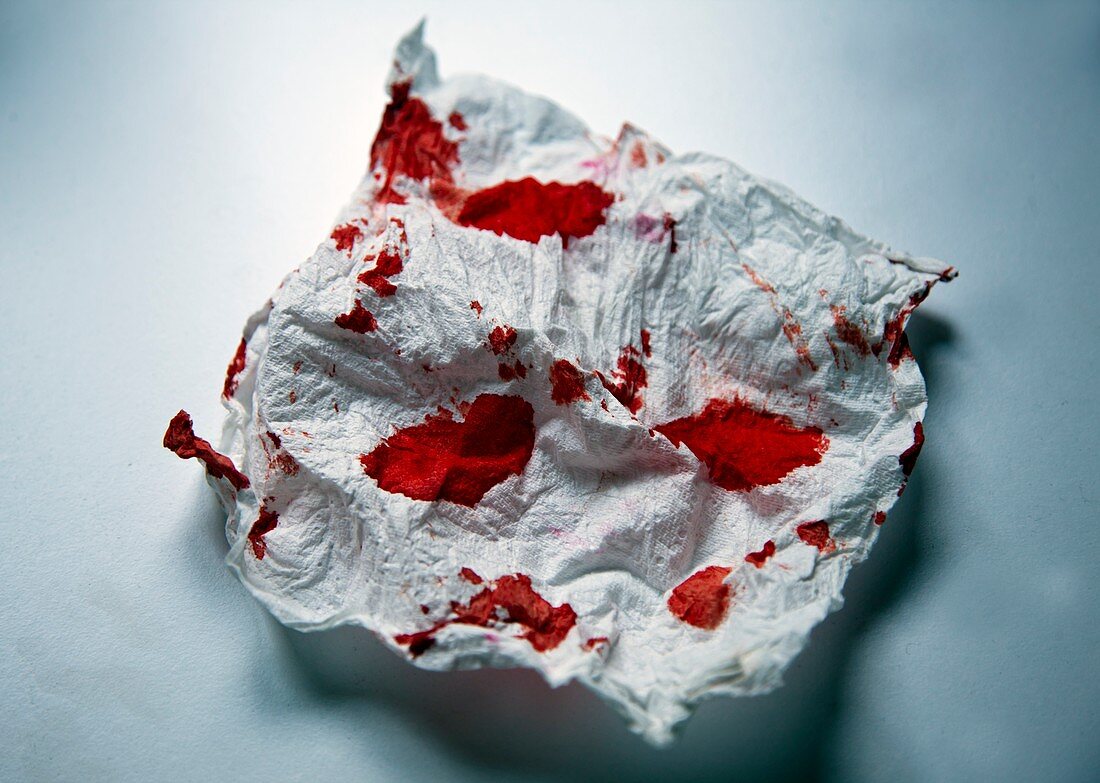 Blood on a paper towel